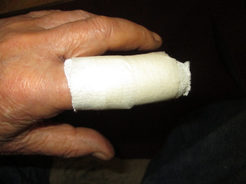 War wound 02