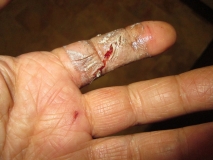 War wound 01