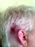 Margaret's press stud