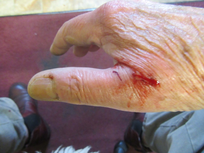 Dog bite 020818