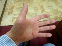 Left hand January 2020