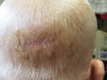 Healed head 310522