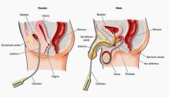 Male and female urinary tract design comparisons
