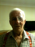 SGafter eye op